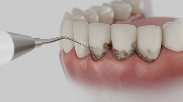 Trusted Teeth Cleaning And Checkup service in Trezevant, TN - Dentist Open Now